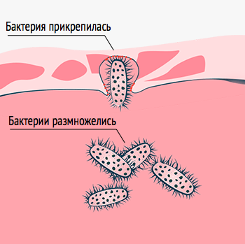 Цистениум